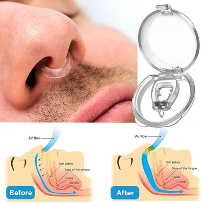 FxshionHQ ® #1 Anti-Snoring Device