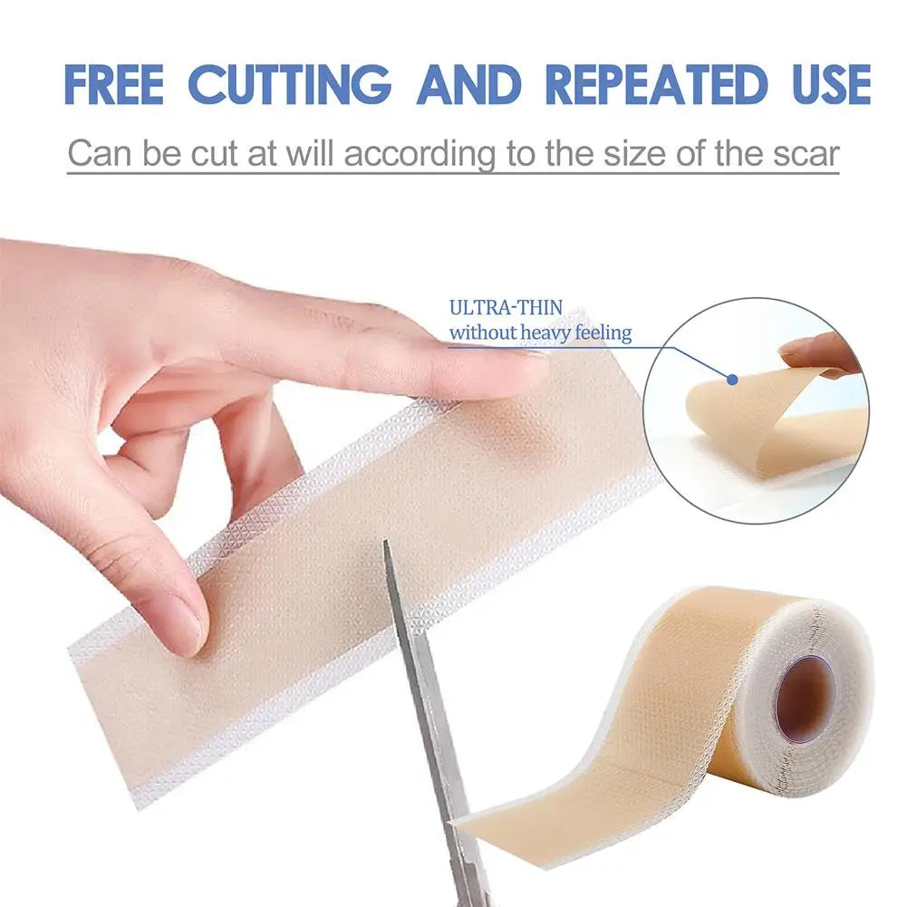 Silicone Scar Sheets ®